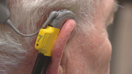 cochlear grandpa 5votz transfer frame 253 Grandfather Back In The Conversation With Cochlear Implant