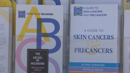 RV Travels To Littleton For Free Skin Cancer Screenings