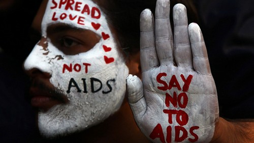South Africans with HIV miss out on the benefits of early treatment due to a fear of stigma